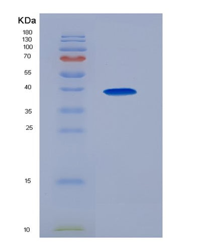 SDS-PAGE analysis of Human CCL3 (C-C Motif Chemokine 3) - Recombinant Protein, CAT# BLT-04355P, showing >85% purity under 15% SDS-PAGE (Reduced)Human CCL3 (C-C Motif Chemokine 3) - Recombinant Protein