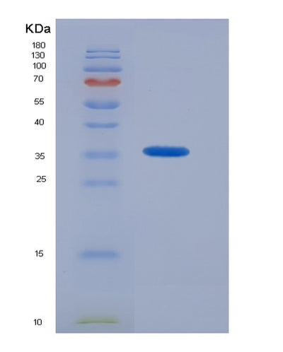SDS-PAGE analysis of Human PTPRS (Receptor-Type Tyrosine-Protein Phosphatase S) - Recombinant Protein, CAT# BLT-07321P, showing >90% purity under 15% SDS-PAGE (Reduced)Human PTPRS (Receptor-Type Tyrosine-Protein Phosphatase S) - Recombinant Protein