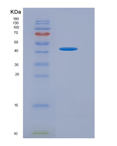 SDS-PAGE analysis of Human AQP4 (Aquaporin-4) - Recombinant Protein, CAT# BLT-07323P, showing >90% purity under 15% SDS-PAGE (Reduced)Human AQP4 (Aquaporin-4) - Recombinant Protein