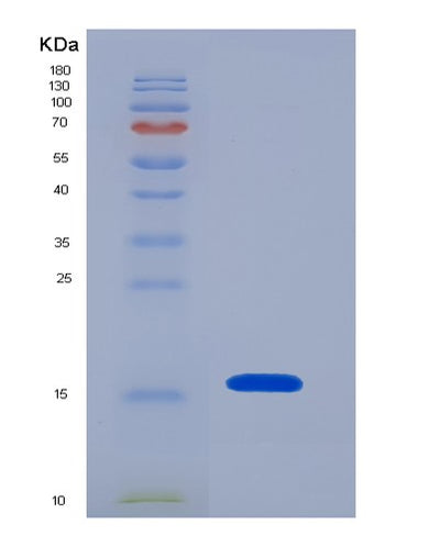 SDS-PAGE analysis of Human CCL24 (C-C Motif Chemokine 24) - Recombinant Protein, CAT# BLT-07324P, showing >90% purity under 15% SDS-PAGE (Reduced)Human CCL24 (C-C Motif Chemokine 24) - Recombinant Protein