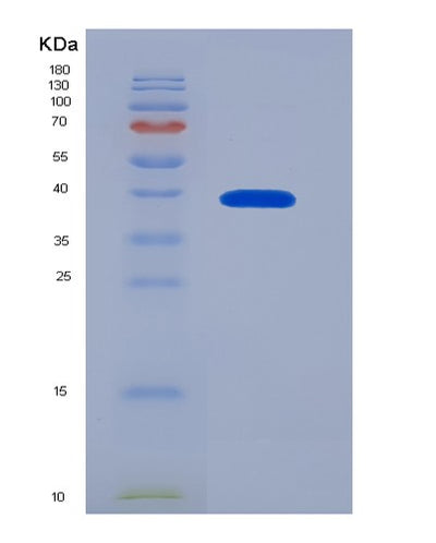 SDS-PAGE analysis of Human LGALS9 (Galectin-9) - Recombinant Protein, CAT# BLT-01147P, showing >85% purity under 15% SDS-PAGE (Reduced)Human LGALS9 (Galectin-9) - Recombinant Protein