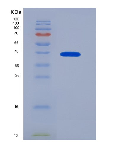 SDS-PAGE analysis of Human LGALS9 (Galectin-9) - Recombinant Protein, CATHuman LGALS9 (Galectin-9) - Recombinant Protein