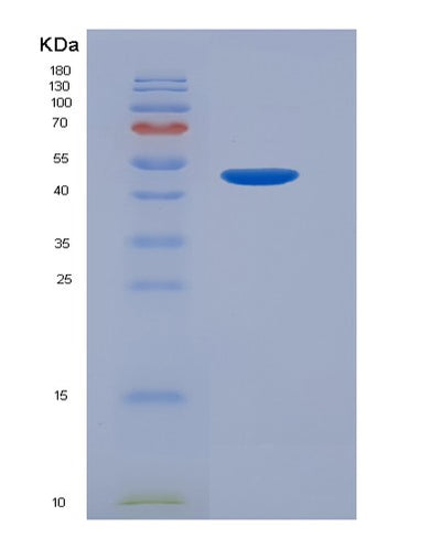 SDS-PAGE analysis of Human LGALS9 (Galectin-9) - Recombinant Protein, CAT# BLT-03755P, showing >90% purity under 15% SDS-PAGE (Reduced)Human LGALS9 (Galectin-9) - Recombinant Protein