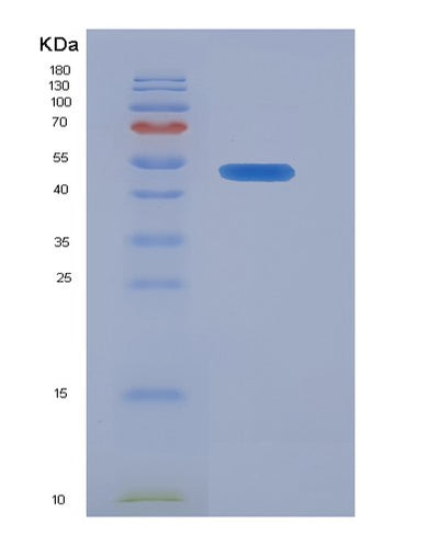 SDS-PAGE analysis of Human KRT18 (Keratin, Type I Cytoskeletal 18) - Recombinant Protein, CAT# BLT-07327P, showing >90% purity under 15% SDS-PAGE (Reduced)Human KRT18 (Keratin, Type I Cytoskeletal 18) - Recombinant Protein