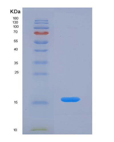 SDS-PAGE analysis of Human AGRP (Agouti-Related Protein) - Recombinant Protein, CAT# BLT-05156P, showing >95% purity under 15% SDS-PAGE (Reduced)Human AGRP (Agouti-Related Protein) - Recombinant Protein