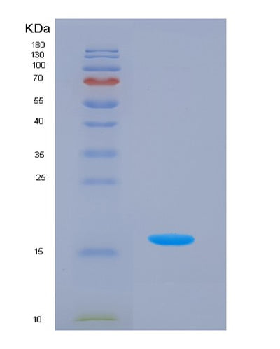 SDS-PAGE analysis of Human LEFTY2 (Left-Right Determination Factor 2) - Recombinant Protein, CAT# BLT-07329P, showing >90% purity under 15% SDS-PAGE (Reduced)Human LEFTY2 (Left-Right Determination Factor 2) - Recombinant Protein