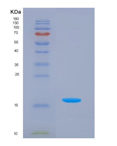 SDS-PAGE analysis of Human LEFTY2 (Left-Right Determination Factor 2) - Recombinant Protein, CATHuman LEFTY2 (Left-Right Determination Factor 2) - Recombinant Protein