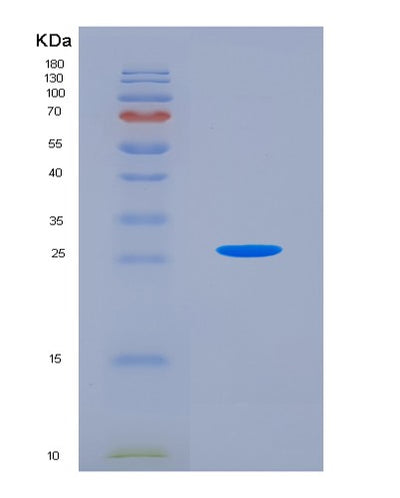 SDS-PAGE analysis of Human CLIC1 (Chloride Intracellular Channel Protein 1) - Recombinant Protein, CAT# BLT-00626P, showing >95% purity under 15% SDS-PAGE (Reduced)Human CLIC1 (Chloride Intracellular Channel Protein 1) - Recombinant Protein