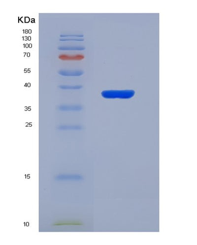 SDS-PAGE analysis of Human EEF2K (Eukaryotic Elongation Factor 2 Kinase) - Recombinant Protein, CAT# BLT-00938P, showing >90% purity under 15% SDS-PAGE (Reduced)Human EEF2K (Eukaryotic Elongation Factor 2 Kinase) - Recombinant Protein