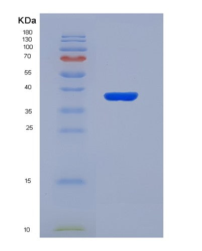 SDS-PAGE analysis of Human EEF2K (Eukaryotic Elongation Factor 2 Kinase) - Recombinant Protein, CATHuman EEF2K (Eukaryotic Elongation Factor 2 Kinase) - Recombinant Protein