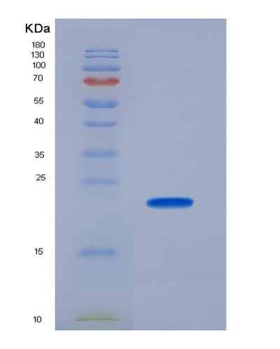 SDS-PAGE analysis of Mouse Tlr7 (Toll-Like Receptor 7) - Recombinant Protein, CAT# BLT-07336P, showing >90% purity under 15% SDS-PAGE (Reduced)Mouse Tlr7 (Toll-Like Receptor 7) - Recombinant Protein