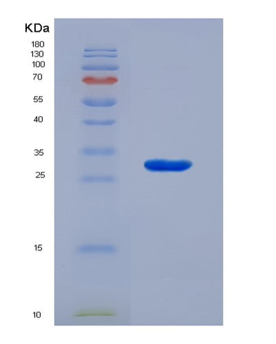 SDS-PAGE analysis of Human VWA1 (Von Willebrand Factor A Domain-Containing Protein 1) - Recombinant Protein, CAT# BLT-07337P, showing >90% purity under 15% SDS-PAGE (Reduced)Human VWA1 (Von Willebrand Factor A Domain-Containing Protein 1) - Recombinant Protein