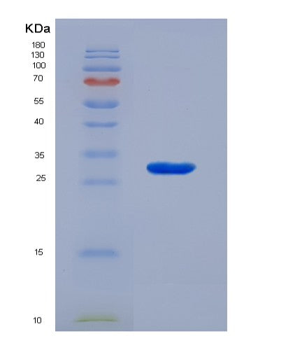SDS-PAGE analysis of Human VWA1 (Von Willebrand Factor A Domain-Containing Protein 1) - Recombinant Protein, CATHuman VWA1 (Von Willebrand Factor A Domain-Containing Protein 1) - Recombinant Protein