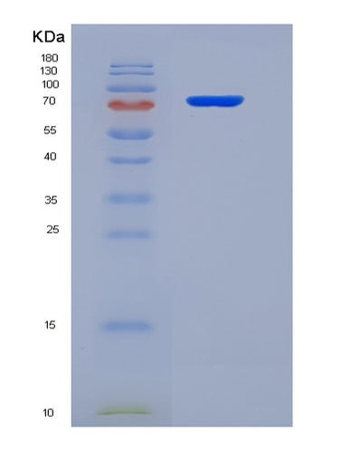SDS-PAGE analysis of Human HSP90AA1 (Heat Shock Protein Hsp 90-Alpha) - Recombinant Protein, CAT# BLT-07338P, showing >90% purity under 15% SDS-PAGE (Reduced)Human HSP90AA1 (Heat Shock Protein Hsp 90-Alpha) - Recombinant Protein