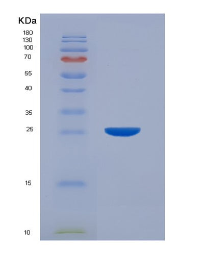 SDS-PAGE analysis of Human FBP2 (Fructose-1,6-Bisphosphatase Isozyme 2) - Recombinant Protein, CAT# BLT-01057P, showing >95% purity under 15% SDS-PAGE (Reduced)Human FBP2 (Fructose-1,6-Bisphosphatase Isozyme 2) - Recombinant Protein
