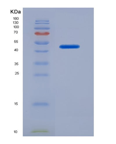 SDS-PAGE analysis of Human CFH (Complement Factor H) - Recombinant Protein, CAT# BLT-07344P, showing >90% purity under 15% SDS-PAGE (Reduced)Human CFH (Complement Factor H) - Recombinant Protein