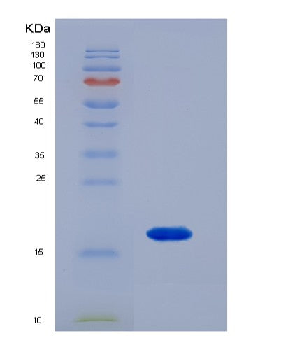 SDS-PAGE analysis of Human SPRR1A (Cornifin-A) - Recombinant Protein, CATHuman SPRR1A (Cornifin-A) - Recombinant Protein