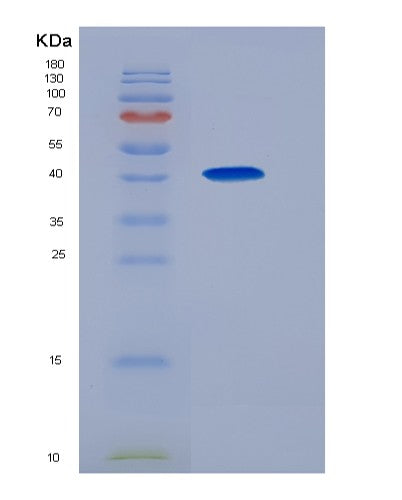 SDS-PAGE analysis of Human AMY1A (Alpha-Amylase 1A) - Recombinant Protein, CATHuman AMY1A (Alpha-Amylase 1A) - Recombinant Protein