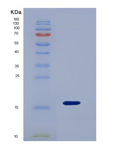 SDS-PAGE analysis of Mouse Lgals9 (Galectin-9) - Recombinant Protein, CAT# BLT-01713P, showing >90% purity under 15% SDS-PAGE (Reduced)Mouse Lgals9 (Galectin-9) - Recombinant Protein