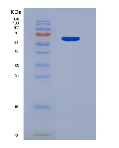 SDS-PAGE analysis of Mouse Map2 (Microtubule-Associated Protein 2) - Recombinant Protein, CAT# BLT-07352P, showing >90% purity under 15% SDS-PAGE (Reduced)Mouse Map2 (Microtubule-Associated Protein 2) - Recombinant Protein