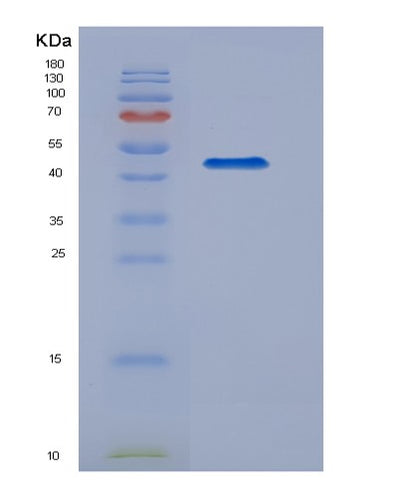 SDS-PAGE analysis of Mouse Kng1 (Kininogen-1) - Recombinant Protein, CAT# BLT-07354P, showing >90% purity under 15% SDS-PAGE (Reduced)Mouse Kng1 (Kininogen-1) - Recombinant Protein