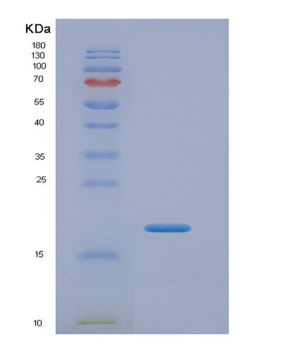 SDS-PAGE analysis of Mouse Il13ra1 (Interleukin-13 Receptor Subunit Alpha-1) - Recombinant Protein, CAT# BLT-07356P, showing >90% purity under 15% SDS-PAGE (Reduced)Mouse Il13ra1 (Interleukin-13 Receptor Subunit Alpha-1) - Recombinant Protein