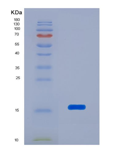 SDS-PAGE analysis of Mouse Reg3a (Regenerating Islet-Derived Protein 3-Alpha) - Recombinant Protein, CAT# BLT-07357P, showing >90% purity under 15% SDS-PAGE (Reduced)Mouse Reg3a (Regenerating Islet-Derived Protein 3-Alpha) - Recombinant Protein