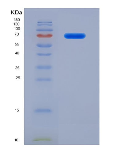 SDS-PAGE analysis of Human COL3A1 (Collagen Alpha-1(Iii) Chain) - Recombinant Protein, CAT# BLT-07359P, showing >90% purity under 15% SDS-PAGE (Reduced)Human COL3A1 (Collagen Alpha-1(Iii) Chain) - Recombinant Protein