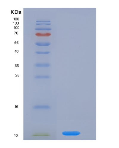 SDS-PAGE analysis of Mouse Nrg4 (Pro-Neuregulin-4, Membrane-Bound Isoform) - Recombinant Protein, CAT# BLT-07360P, showing >90% purity under 15% SDS-PAGE (Reduced)Mouse Nrg4 (Pro-Neuregulin-4, Membrane-Bound Isoform) - Recombinant Protein