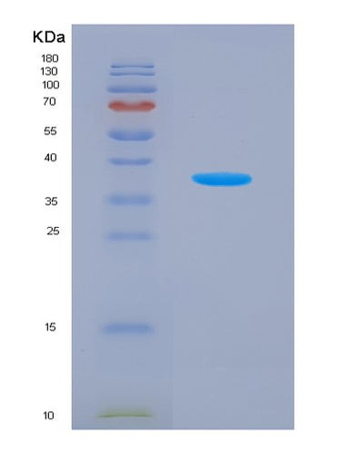 SDS-PAGE analysis of Mouse C3 (Complement C3) - Recombinant Protein, CAT# BLT-04030P, showing >95% purity under 15% SDS-PAGE (Reduced)Mouse C3 (Complement C3) - Recombinant Protein