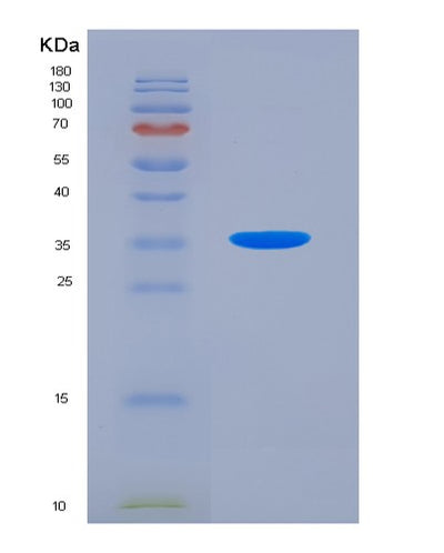 SDS-PAGE analysis of Human MTOR (Serine/Threonine-Protein Kinase Mtor) - Recombinant Protein, CAT# BLT-07361P, showing >90% purity under 15% SDS-PAGE (Reduced)Human MTOR (Serine/Threonine-Protein Kinase Mtor) - Recombinant Protein