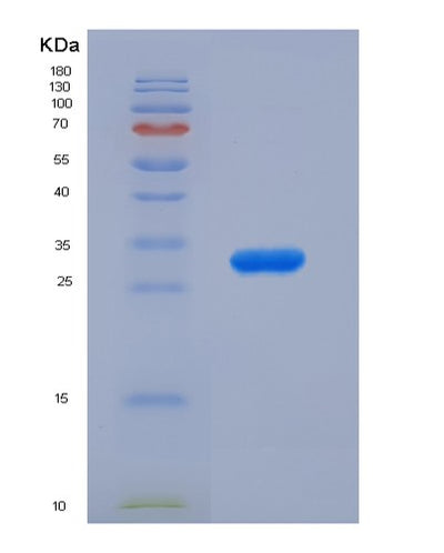 SDS-PAGE analysis of Human ALOX5 (Polyunsaturated Fatty Acid 5-Lipoxygenase) - Recombinant Protein, CAT# BLT-07362P, showing >90% purity under 15% SDS-PAGE (Reduced)Human ALOX5 (Polyunsaturated Fatty Acid 5-Lipoxygenase) - Recombinant Protein