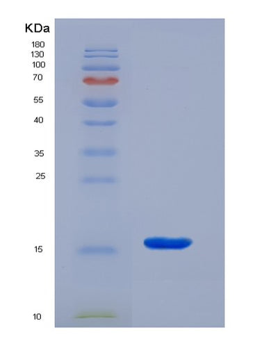 SDS-PAGE analysis of Mouse Sema4d (Semaphorin-4D) - Recombinant Protein, CAT# BLT-07363P, showing >90% purity under 15% SDS-PAGE (Reduced)Mouse Sema4d (Semaphorin-4D) - Recombinant Protein