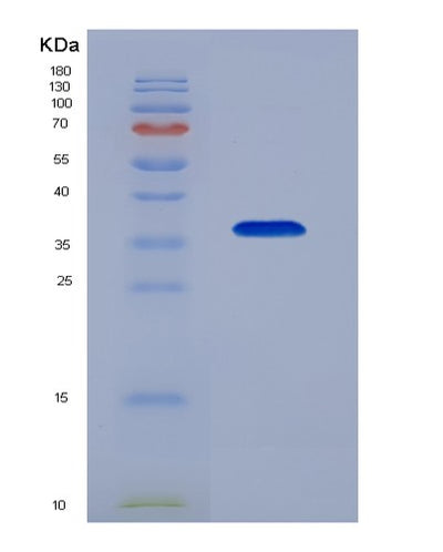 SDS-PAGE analysis of Human TOR1A (Torsin-1A) - Recombinant Protein, CAT# BLT-03100P, showing >90% purity under 15% SDS-PAGE (Reduced)Human TOR1A (Torsin-1A) - Recombinant Protein