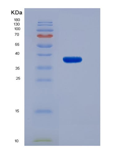 SDS-PAGE analysis of Human TPP1 (Tripeptidyl-Peptidase 1) - Recombinant Protein, CAT# BLT-07365P, showing >90% purity under 15% SDS-PAGE (Reduced)Human TPP1 (Tripeptidyl-Peptidase 1) - Recombinant Protein