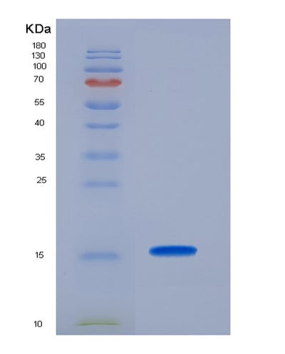 SDS-PAGE analysis of Human NCR3 (Natural Cytotoxicity Triggering Receptor 3) - Recombinant Protein, CAT# BLT-07368P, showing >90% purity under 15% SDS-PAGE (Reduced)Human NCR3 (Natural Cytotoxicity Triggering Receptor 3) - Recombinant Protein