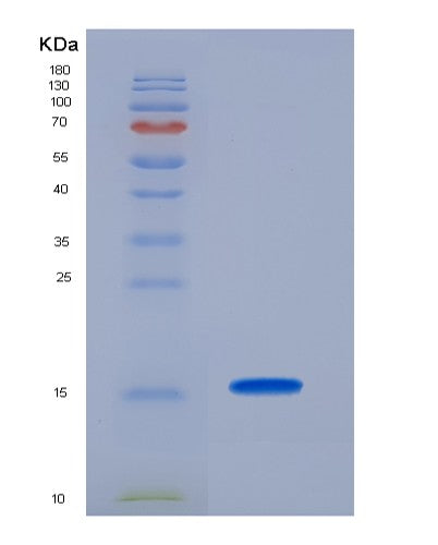 SDS-PAGE analysis of Human NCR3 (Natural Cytotoxicity Triggering Receptor 3) - Recombinant Protein, CATHuman NCR3 (Natural Cytotoxicity Triggering Receptor 3) - Recombinant Protein