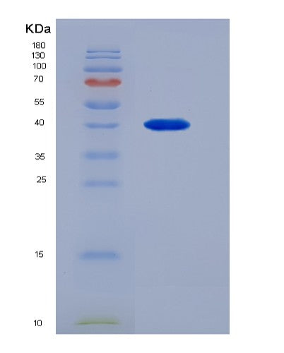 SDS-PAGE analysis of Human Calmegin (CLGN) - Recombinant Protein, CATHuman Calmegin (CLGN) - Recombinant Protein