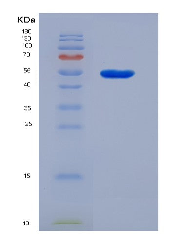 SDS-PAGE analysis of Human GFAP (Glial Fibrillary Acidic Protein) - Recombinant Protein, CATHuman GFAP (Glial Fibrillary Acidic Protein) - Recombinant Protein