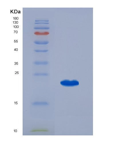 SDS-PAGE analysis of Human CCL25 (C-C Motif Chemokine 25) - Recombinant Protein, CATHuman CCL25 (C-C Motif Chemokine 25) - Recombinant Protein