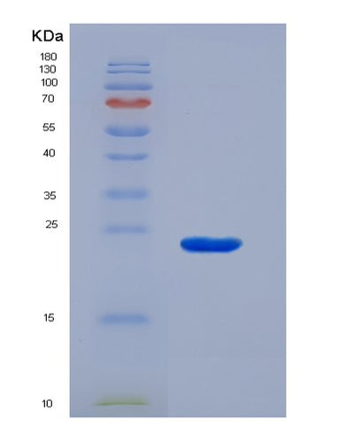 SDS-PAGE analysis of Mouse Omd (Osteomodulin) - Recombinant Protein, CAT# BLT-07377P, showing >90% purity under 15% SDS-PAGE (Reduced)Mouse Omd (Osteomodulin) - Recombinant Protein