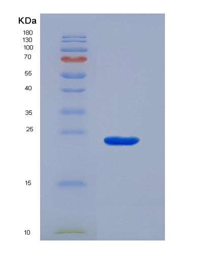 SDS-PAGE analysis of Mouse Omd (Osteomodulin) - Recombinant Protein, CATMouse Omd (Osteomodulin) - Recombinant Protein