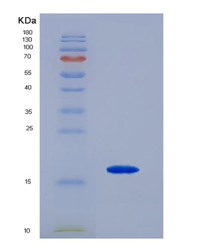 SDS-PAGE analysis of Mouse Tnfrsf18 (Tumor Necrosis Factor Receptor Superfamily Member 18) - Recombinant Protein, CAT# BLT-07383P, showing >90% purity under 15% SDS-PAGE (Reduced)Mouse Tnfrsf18 (Tumor Necrosis Factor Receptor Superfamily Member 18) - Recombinant Protein