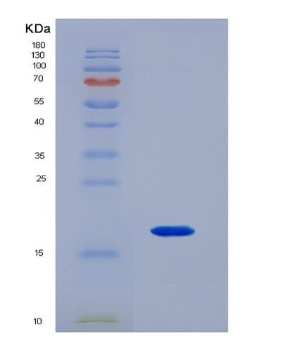 SDS-PAGE analysis of Mouse Sdc4 (Syndecan-4) - Recombinant Protein, CAT# BLT-07384P, showing >90% purity under 15% SDS-PAGE (Reduced)Mouse Sdc4 (Syndecan-4) - Recombinant Protein