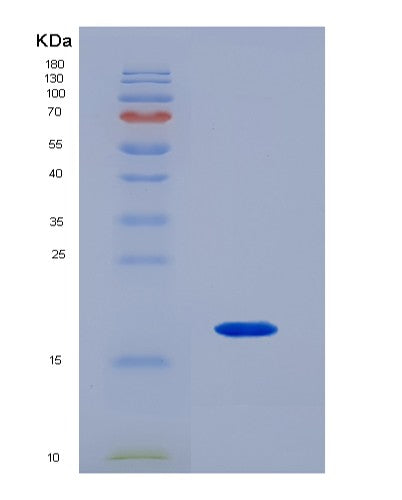 SDS-PAGE analysis of Mouse Sdc4 (Syndecan-4) - Recombinant Protein, CATMouse Sdc4 (Syndecan-4) - Recombinant Protein