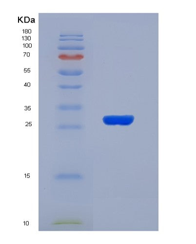 SDS-PAGE analysis of Human FLRT2 (Leucine-Rich Repeat Transmembrane Protein Flrt2) - Recombinant Protein, CATHuman FLRT2 (Leucine-Rich Repeat Transmembrane Protein Flrt2) - Recombinant Protein