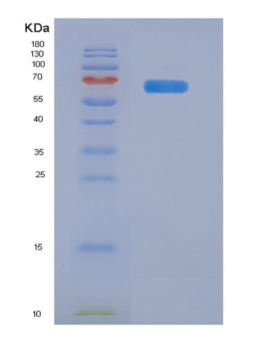 SDS-PAGE analysis of Human ADAM12 (Disintegrin And Metalloproteinase Domain-Containing Protein 12) - Recombinant Protein, CAT# BLT-06836P, showing >85% purity under 15% SDS-PAGE (Reduced)Human ADAM12 (Disintegrin And Metalloproteinase Domain-Containing Protein 12) - Recombinant Protein