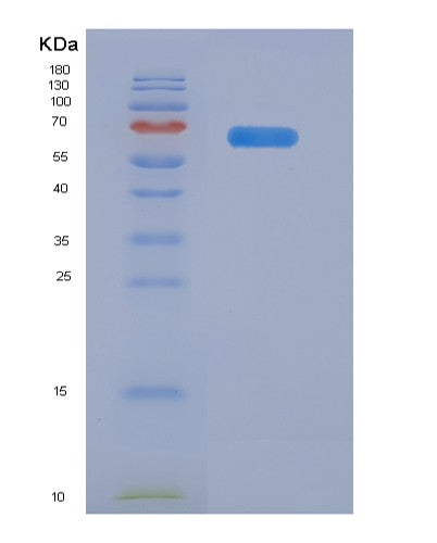 SDS-PAGE analysis of Human ADAM12 (Disintegrin And Metalloproteinase Domain-Containing Protein 12) - Recombinant Protein, CATHuman ADAM12 (Disintegrin And Metalloproteinase Domain-Containing Protein 12) - Recombinant Protein