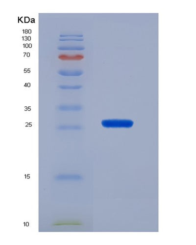 SDS-PAGE analysis of Human FOXA1 (Hepatocyte Nuclear Factor 3-Alpha) - Recombinant Protein, CAT# BLT-07388P, showing >90% purity under 15% SDS-PAGE (Reduced)Human FOXA1 (Hepatocyte Nuclear Factor 3-Alpha) - Recombinant Protein