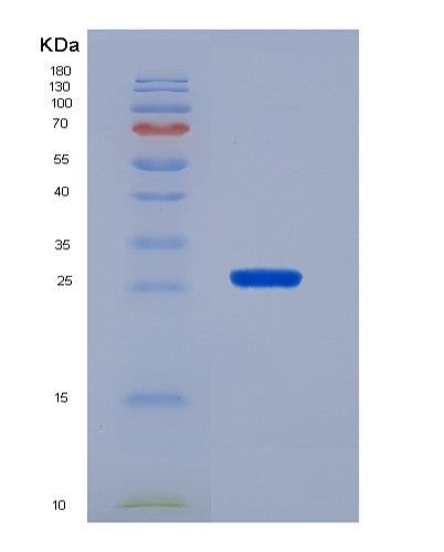 SDS-PAGE analysis of Human FOXA1 (Hepatocyte Nuclear Factor 3-Alpha) - Recombinant Protein, CATHuman FOXA1 (Hepatocyte Nuclear Factor 3-Alpha) - Recombinant Protein